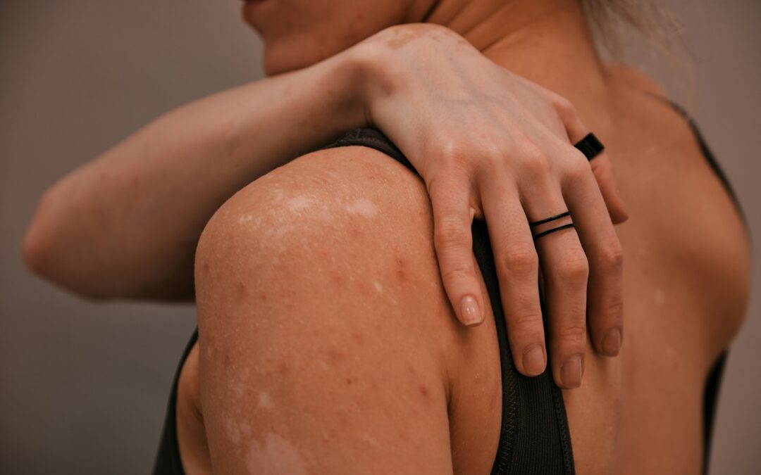 When Should You Reschedule Your Sugaring Appointment?
