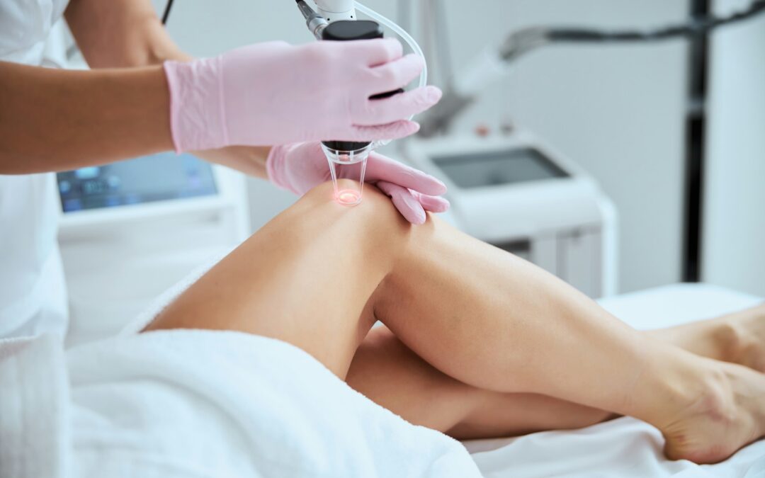 Tips for Choosing Hair Reduction Services That Last